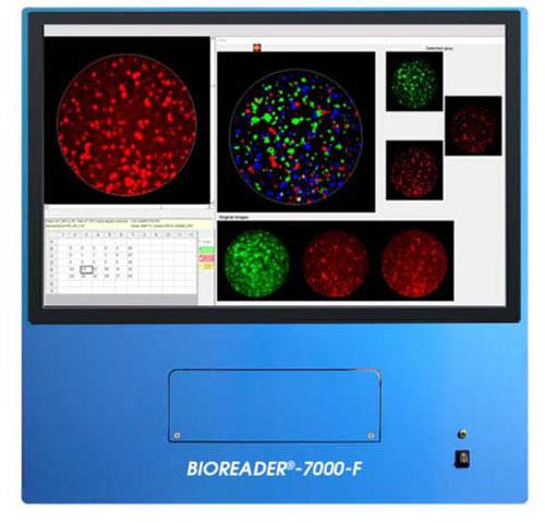Bioreader 7000F 酶联免疫荧光斑点分析仪